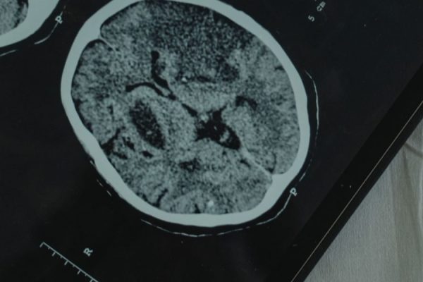 Secure Access and Interpretation of Patient Fusion Portal Mental Health Records